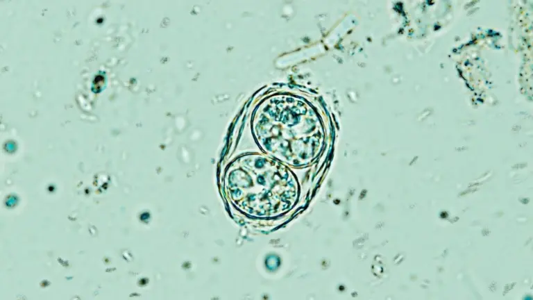 Il parassita cerebrale che infetta milioni di persone è meno dormiente di quanto pensassimo