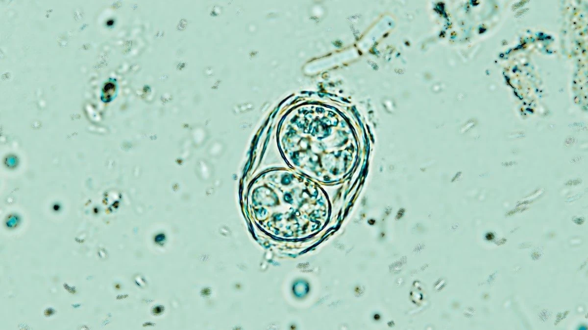 Il parassita cerebrale che infetta milioni di persone è meno dormiente di quanto pensassimo