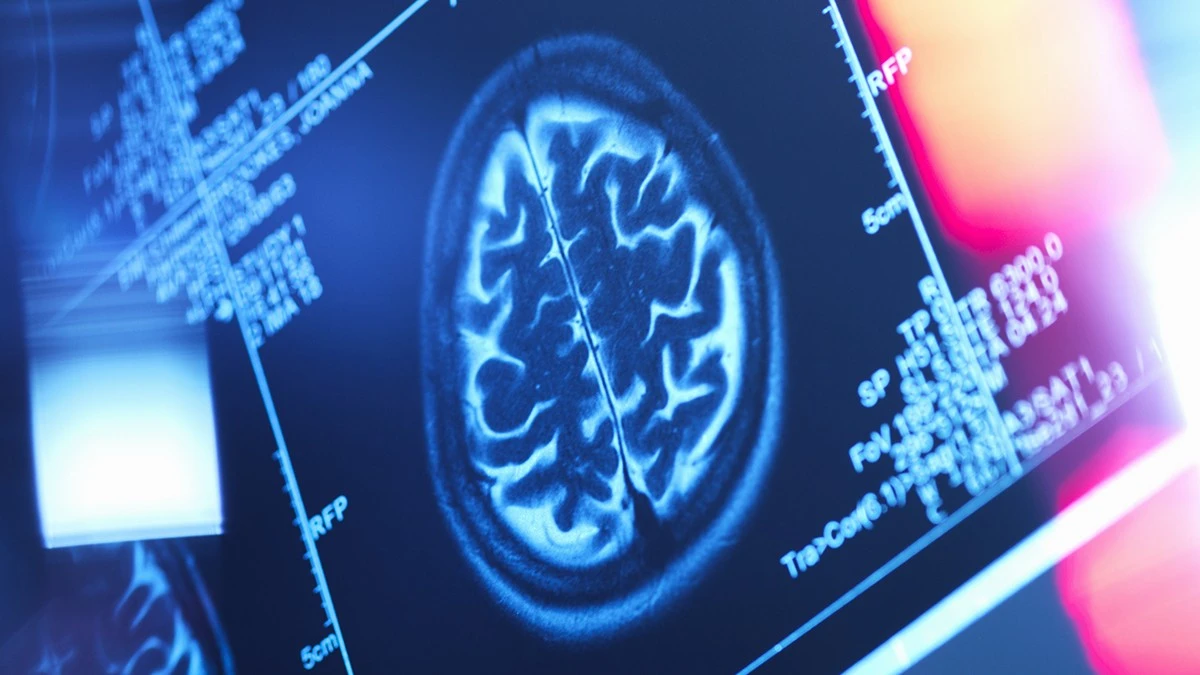 Grasso corporeo: la sua posizione potrebbe minacciare il tuo cervello, secondo uno studio