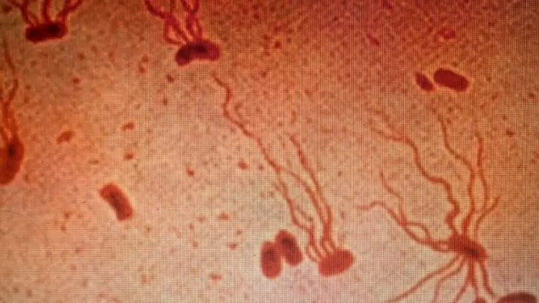 L'antico killer resiste: ecco perché gli antibiotici potrebbero smettere di funzionare
