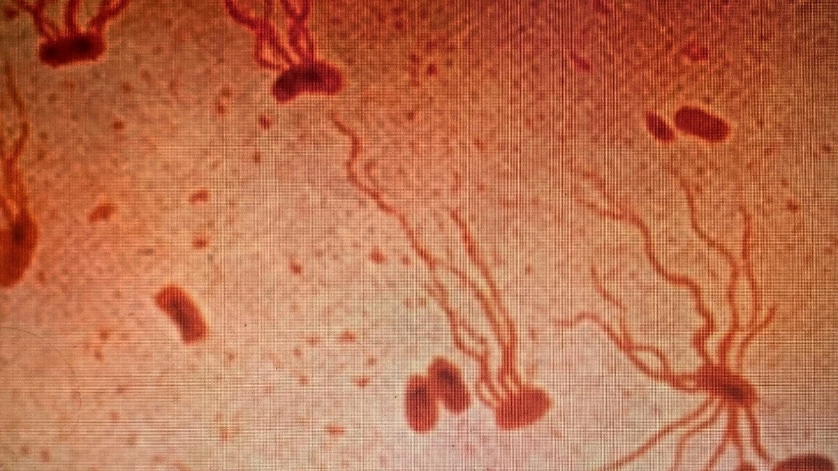 L'antico killer resiste: ecco perché gli antibiotici potrebbero smettere di funzionare