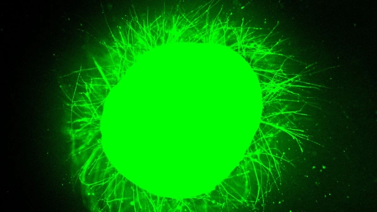 Mini Midolli Umani Cresciuti in Laboratorio: Rivoluzione nella cura delle Paralisi