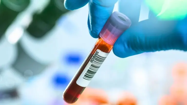 Segnali d'allarme del Parkinson nascosti nel sangue: la nuova scoperta che potrebbe rivoluzionare la diagnosi