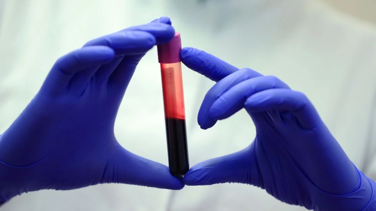 Anidride carbonica nell'aria: potrebbe già influenzare la chimica del tuo sangue