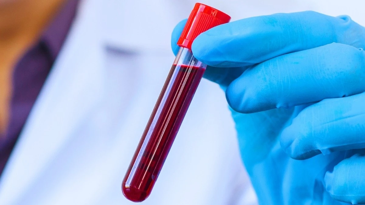 Il sangue dei centenari rivela 37 proteine legate a un invecchiamento più lento