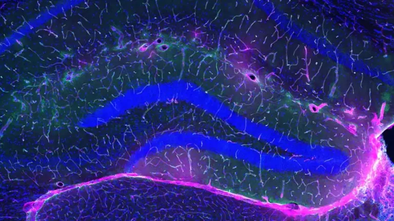 L'esercizio fisico protegge dal declino cognitivo: la scienza svela il meccanismo segreto nel cervello